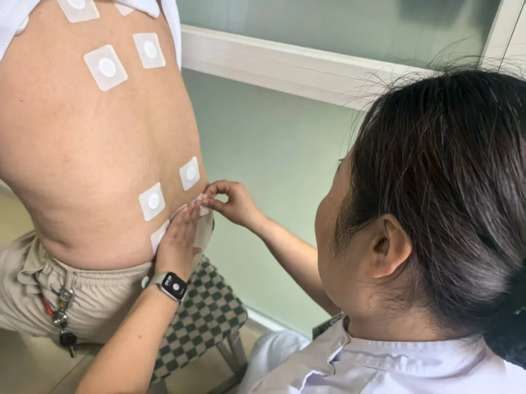 老干部医院三伏贴首日开贴，中医护航引热潮！